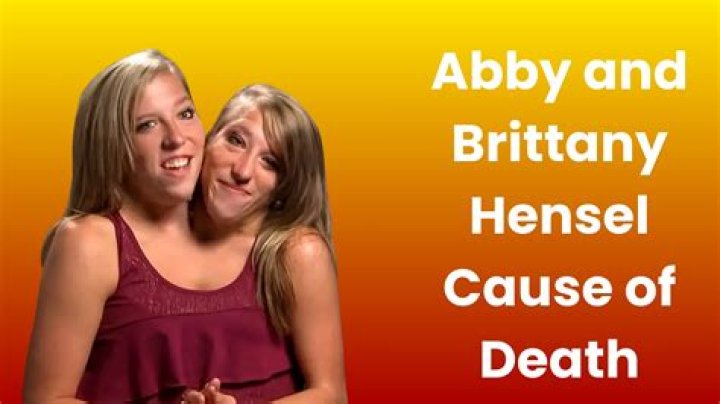 Abby and Brittany Hensel Cause of Death: Unveiling the Truth Behind Their Lives
