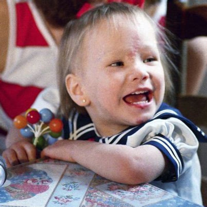 Baby Jessica Injuries: Understanding the Causes, Treatments, and Preventive Measures