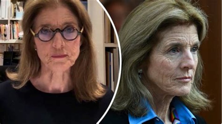 Caroline Kennedy Wrinkles: A Comprehensive Guide to Aging Gracefully