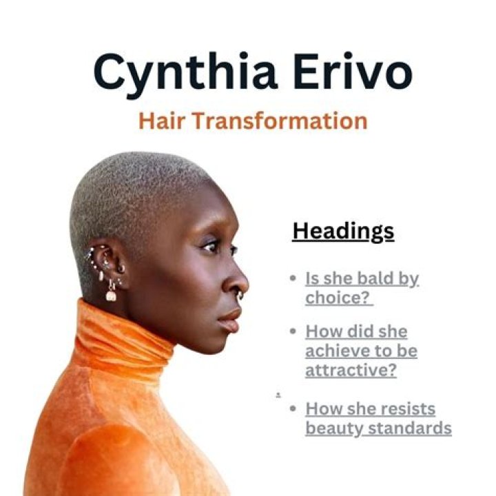 Cynthia Erivo and Her Battle with Alopecia Areata: A Comprehensive Guide
