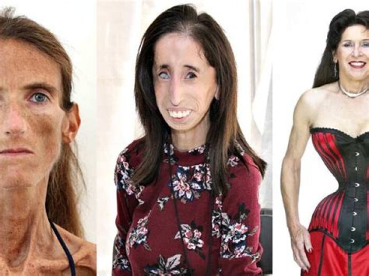 Discover The Ultimate In Slimness: The World's Skinniest