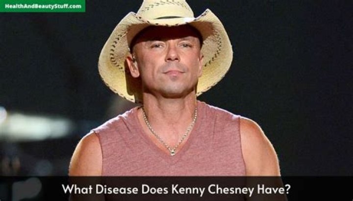 Does Kenny Chesney Have Cancer? Unveiling the Truth Behind the Rumors