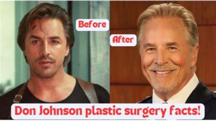 Don Johnson Plastic Surgery: The Untold Story Behind His Transformation