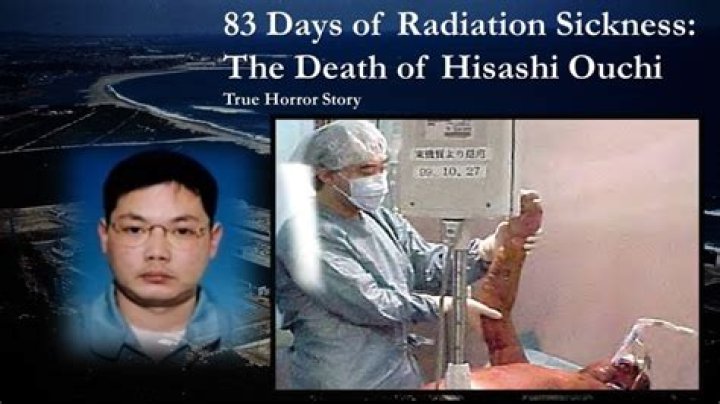 Horrifying Details: Hisashi Ouchi's Real Footage Unveiled