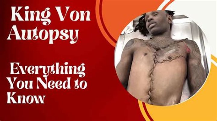 King Von Autopsy Results: Unveiling the Truth Behind the Tragic Loss