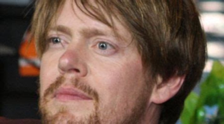 Kris Marshall Face Surgery: Unveiling the Truth Behind the Procedure