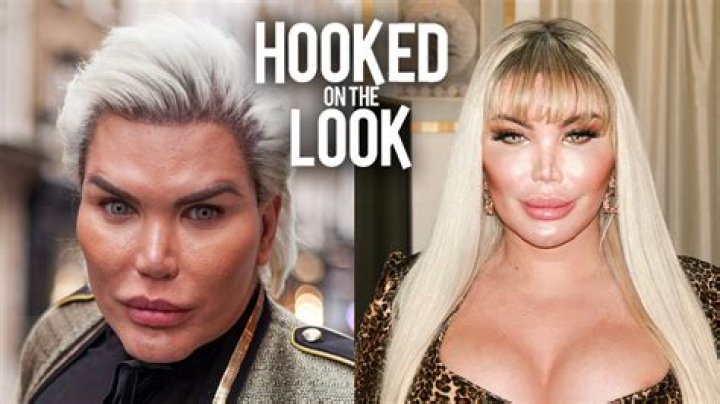 Rodrigo Alves: The Journey of Brazil's Most Influential Plastic Surgery Advocate
