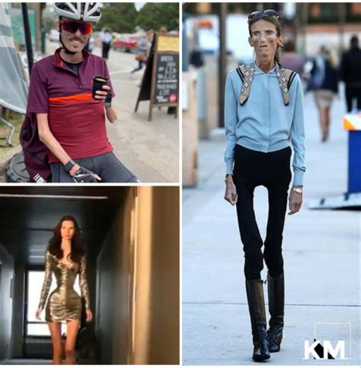 The Thinnest Person in the World: An In-Depth Look