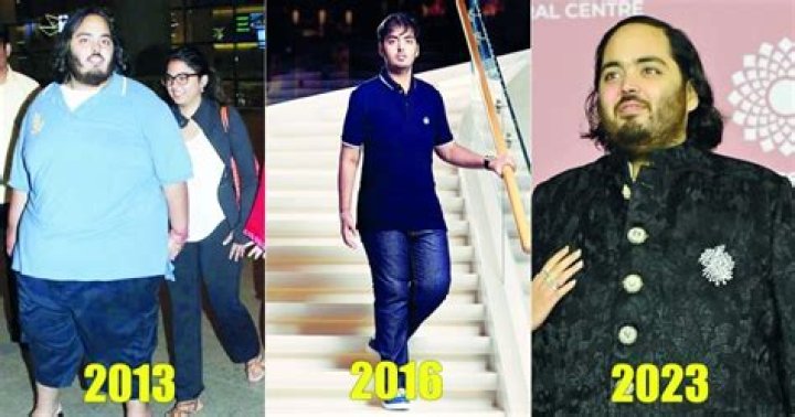 Unraveling The Mystery: Anan Ambani Sakit Apa?